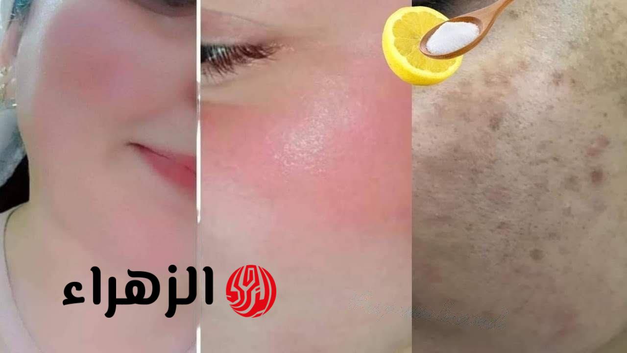 أقوي 4 حبوب من الصيدلية لتبييض الجسم والبشرة فوري هتزيل سواد وبقع وتصبغات 10 سنين