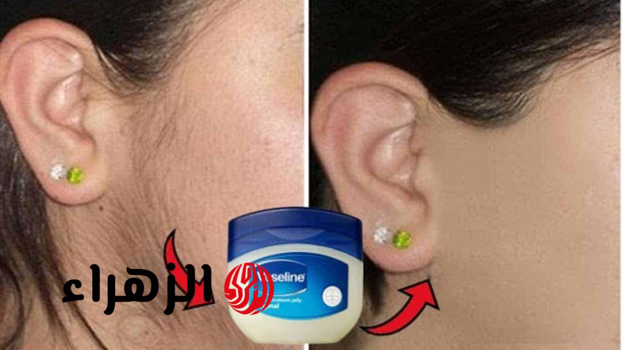 إزالة الشعر بالفازلين ووداعاً للشعر الزائد وجلد الوزة نهائياً بدون ألم