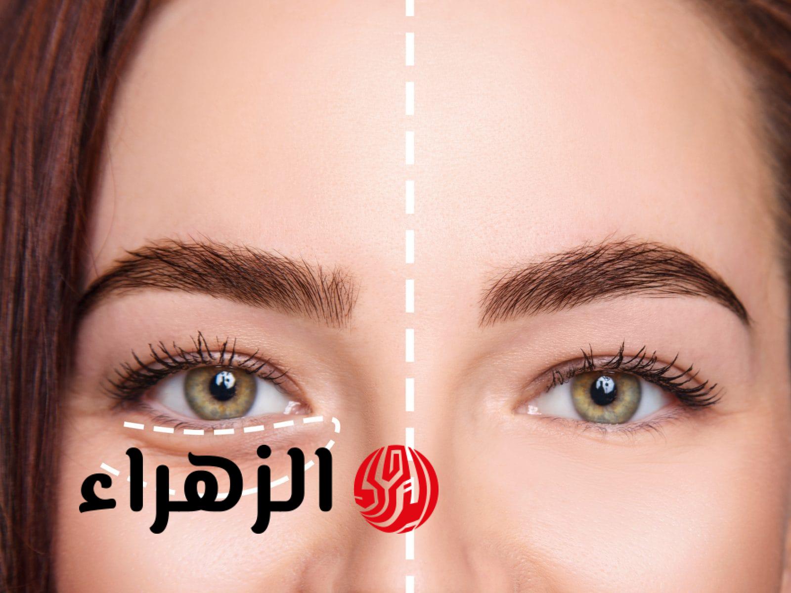 وصفة التجاعيد والهالات السوداء تحت العينين المذهلة والصحية وأضمن من مراكز التجميل والعناية بالبشرة